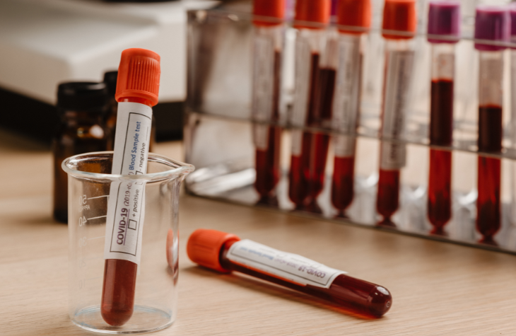 blood testing