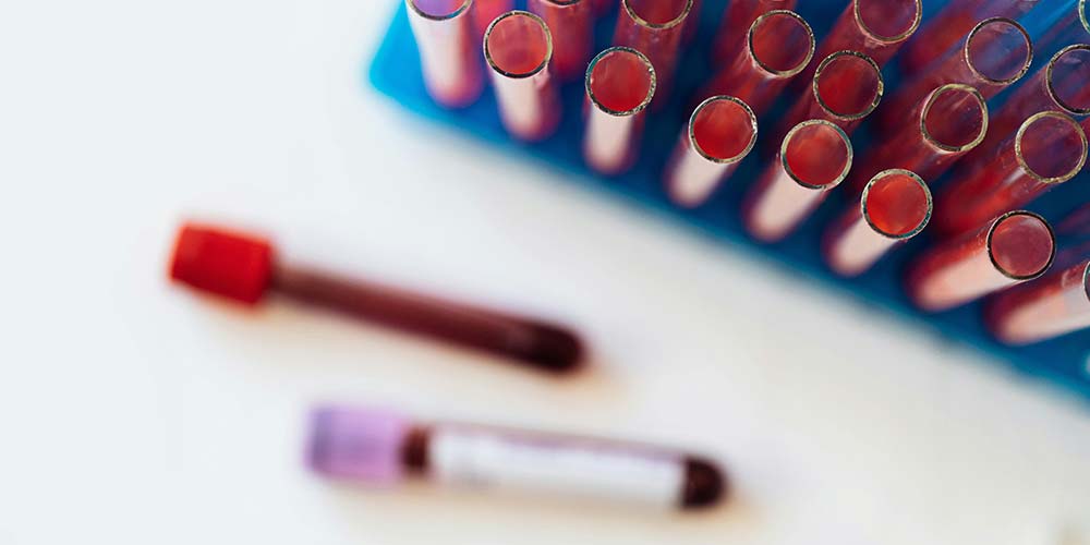 blood test tube