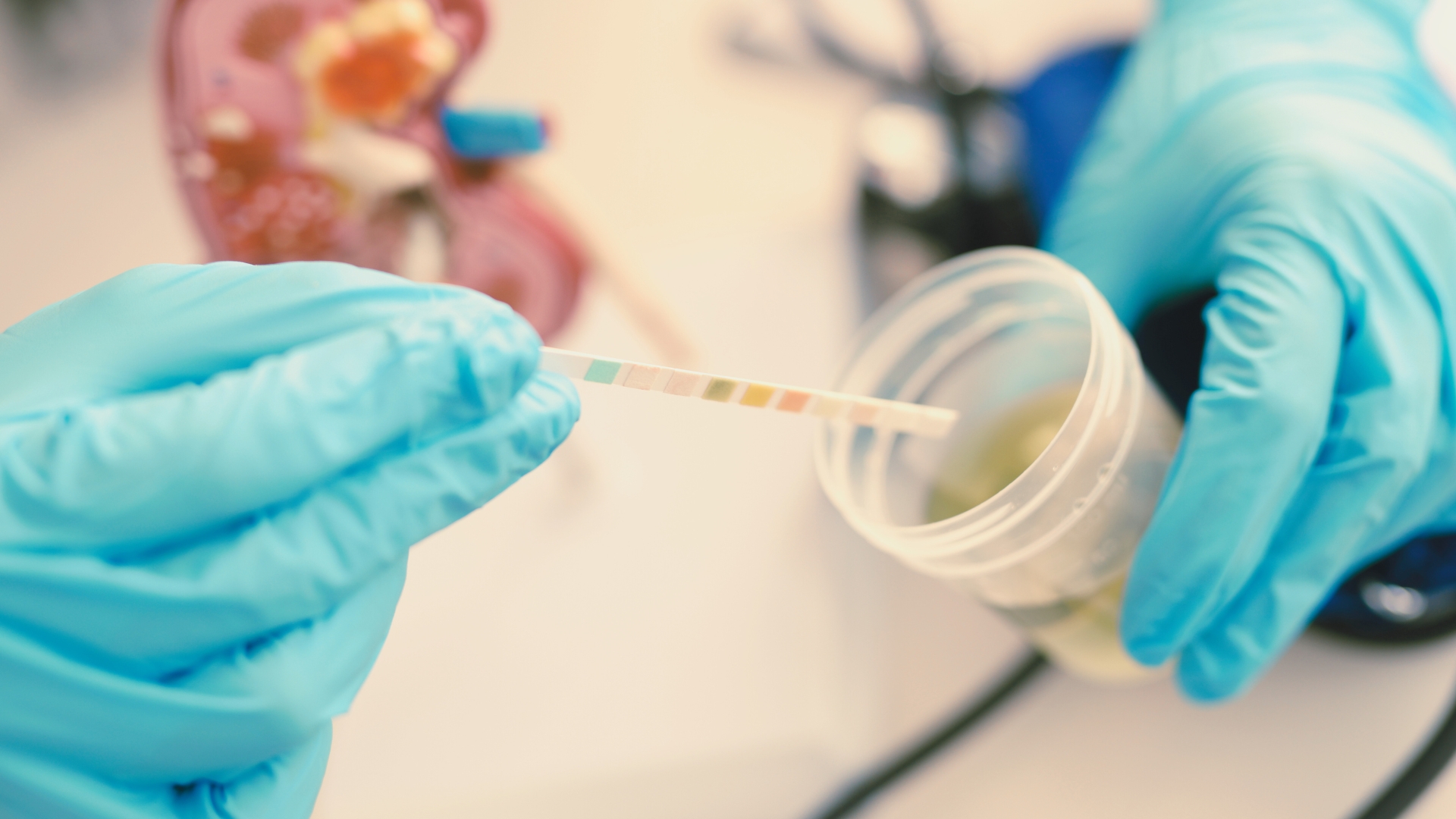 how long does fentanyl stay in urine